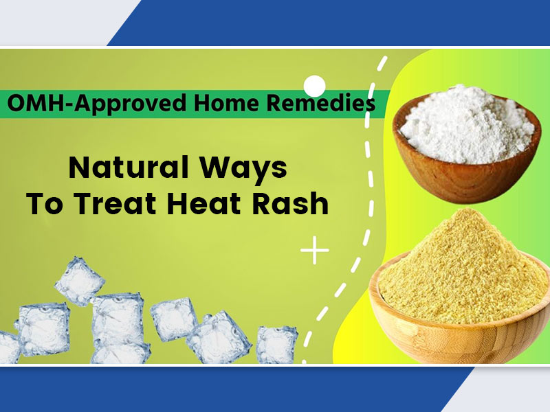 Omh Approved Home Remedies To Treat Heat Rash Or Prickly Heat