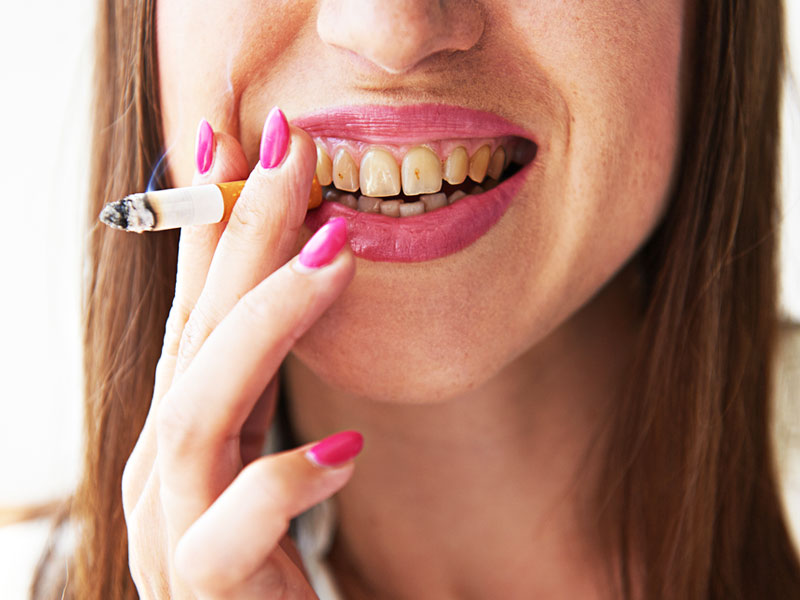 दांत के लिए सिगरेट-बीड़ी पीना है कितना घातक? डेंटिस्ट से जानें स्मोकिंग से दांतों को कैसे पहुंचता है नुकसान