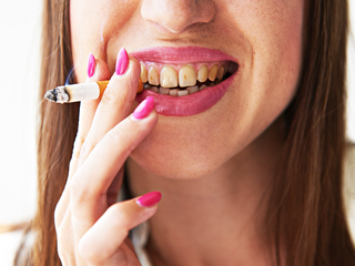 दांत के लिए सिगरेट-बीड़ी पीना है कितना घातक? डेंटिस्ट से जानें स्मोकिंग से दांतों को कैसे पहुंचता है नुकसान