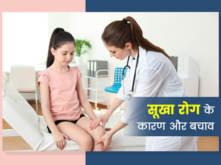 बच्चों में बढ़ रहे हैं रिकेट्स (सूखा रोग) के मामले, डॉक्टर से जानें इस बीमारी का कारण, लक्षण, बचाव के उपाय