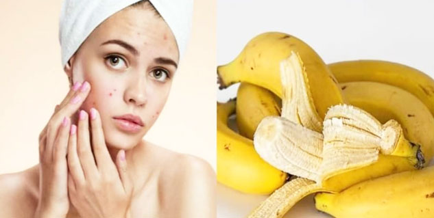 banana face mask