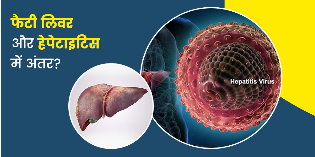 Difference Between Fatty Liver and Hepatitis in Hindi फैटी लिवर और