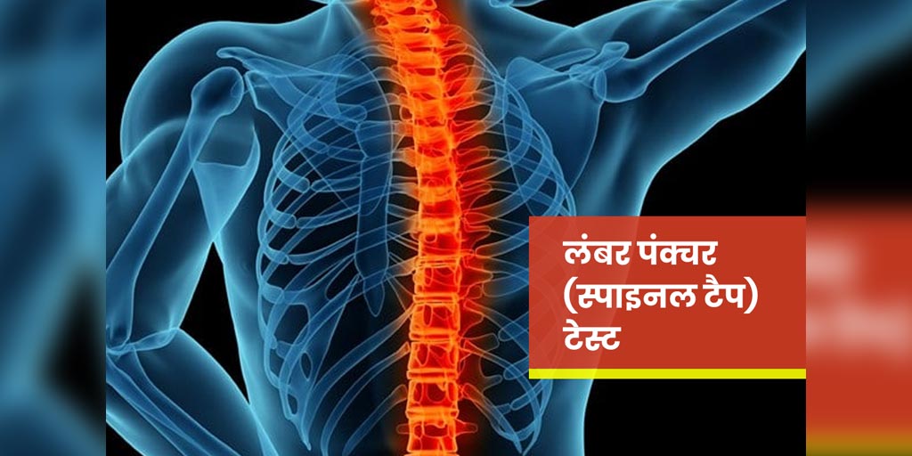 What is Lumbar Puncture or Spinal Tap Test And Why is it Done लंबर