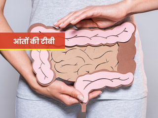 खाते ही उल्टी और पेट के निचले हिस्से में दर्द हो सकते हैं आंतों में टीबी के लक्षण, जानें कारण, लक्षण और उपाय