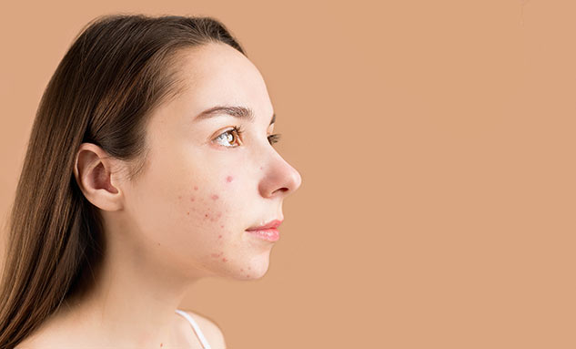 wrinkle_free_skin_after_treatment