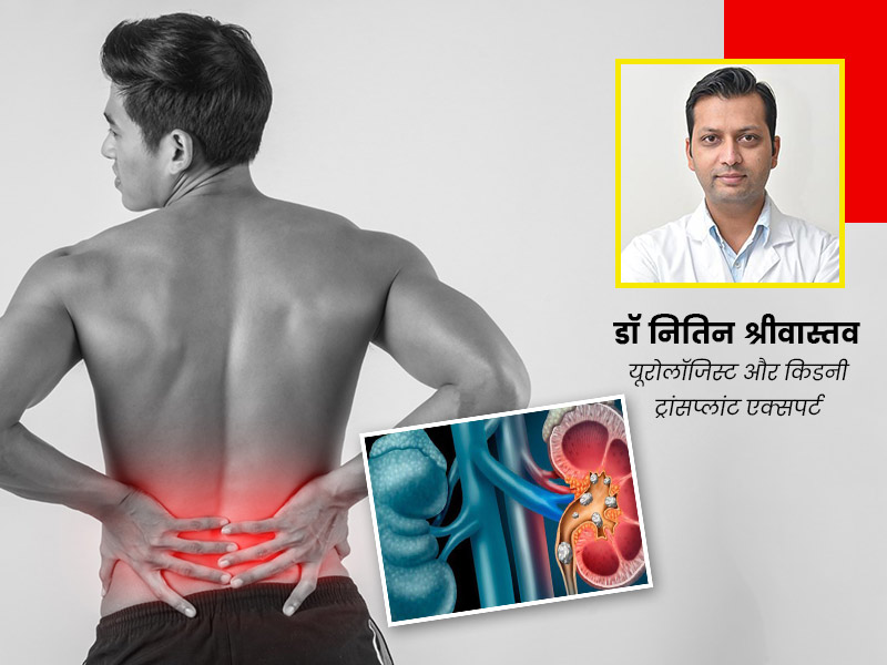 इन 10 कारणों से बढ़ता है किडनी की पथरी (किडनी स्टोन) का खतरा, डॉक्टर से जानें इनसे बचाव के लिए क्या करें