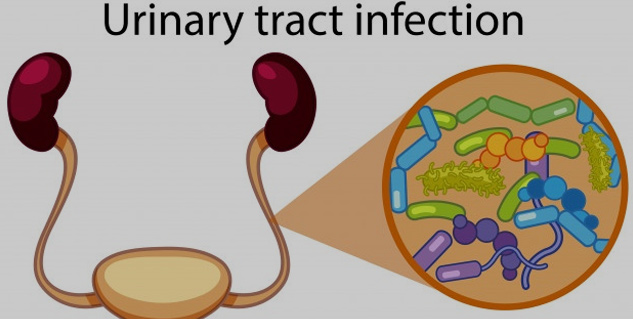 Urinary Tract Infection In Pregnancy: Know Causes, Symptoms and Prevention  Tips