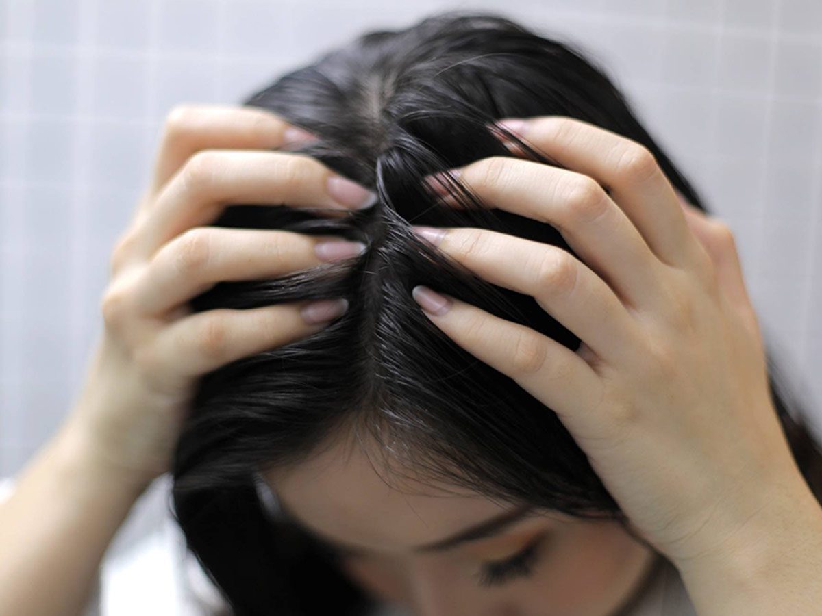 Long For A Clean And Fresh Scalp? Try These 5 Home Remedies For Desired  Results