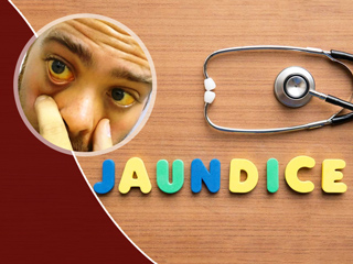 पीलिया हाेने पर तुरंत बंद कर दें इन 6 चीजाें का सेवन, डायटीशियन से जानें ऐसा न करने के नुकसान