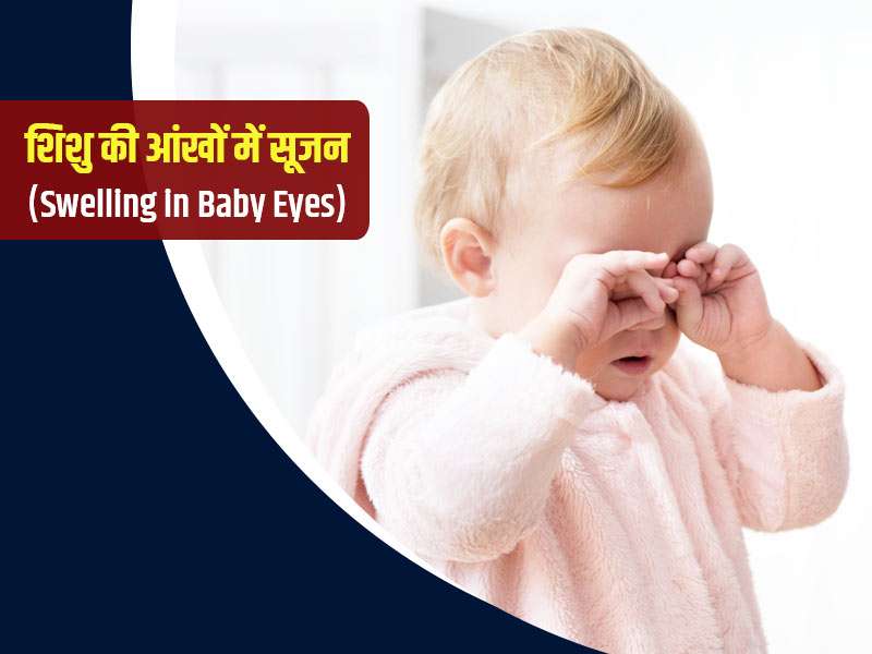 शिशु की आंखों में सूजन के क्या कारण हो सकते हैं? जानें इसका इलाज और बचाव के टिप्स