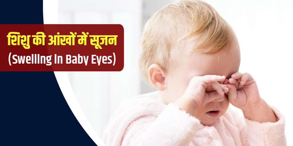 Eye swelling in infants causes symptoms treatment in hindi। शिशु की