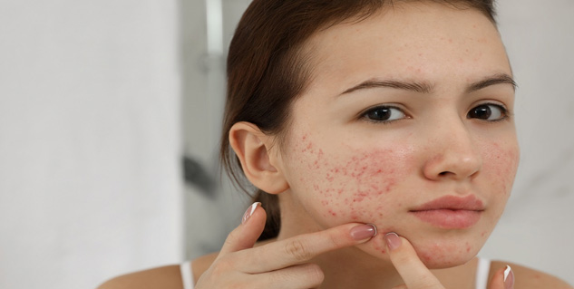 neem oil for skin