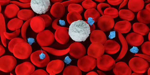 Blood-Disorders