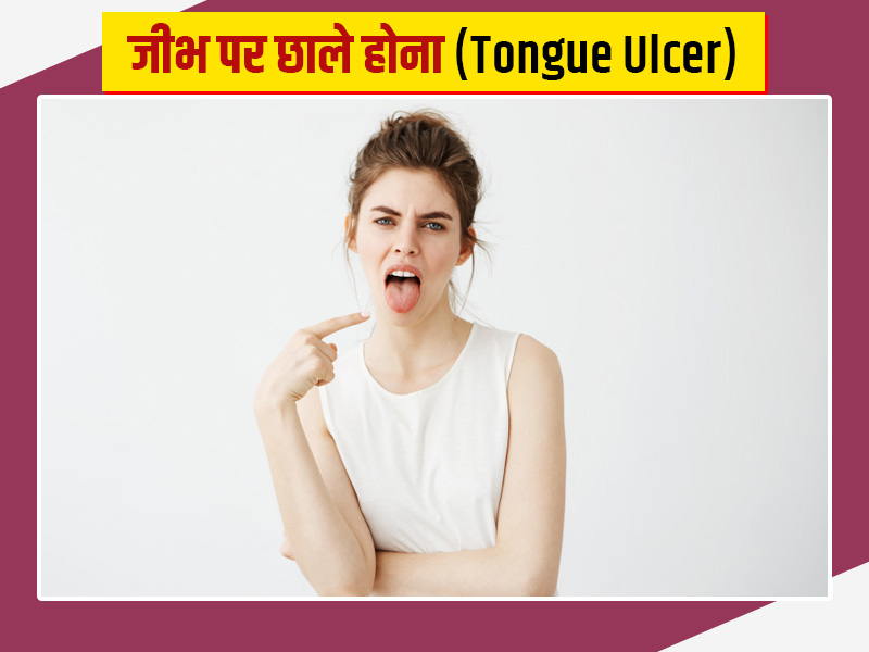जीभ पर छाले क्यों पड़ते हैं? जानें इन छालों का कारण, लक्षण और घरेलू उपाय