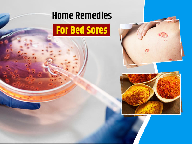 Period rash? Try these 3 home remedies for instant relief