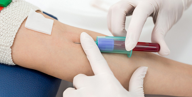 pre pregnancy important test