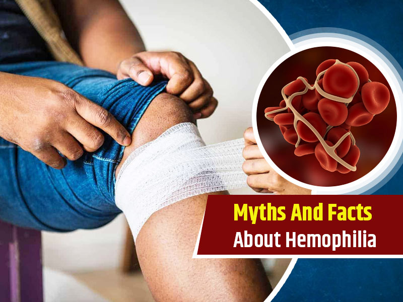 Haemophilia Blood Disorder: Know 7 Myths And Surprising Facts Behind This Disorder