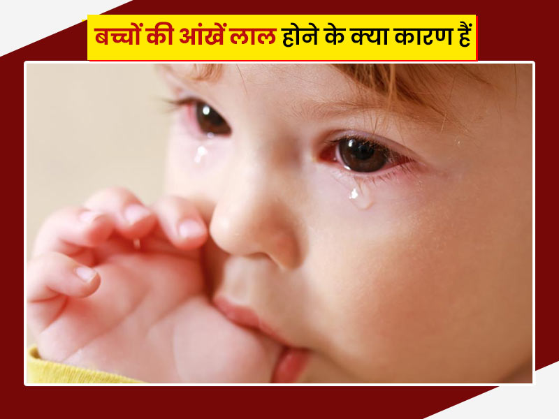 शिशुओं की आंखे लाल होने के क्या कारण हो सकते हैं? एक्सपर्ट से जानें इसे ठीक करने के सुरक्षित घरेलू उपाय