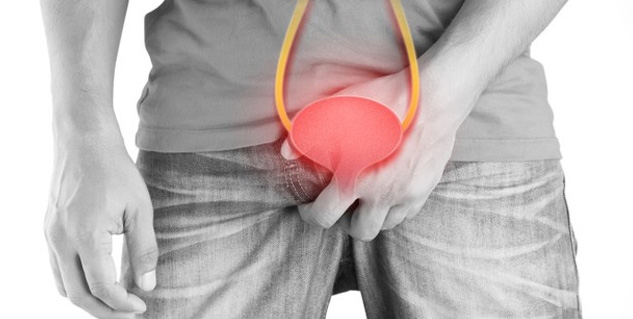 Bladder-Stone_operation