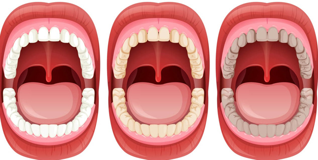 Uvula Swelling Symptoms Causes Treatment Of This Condition