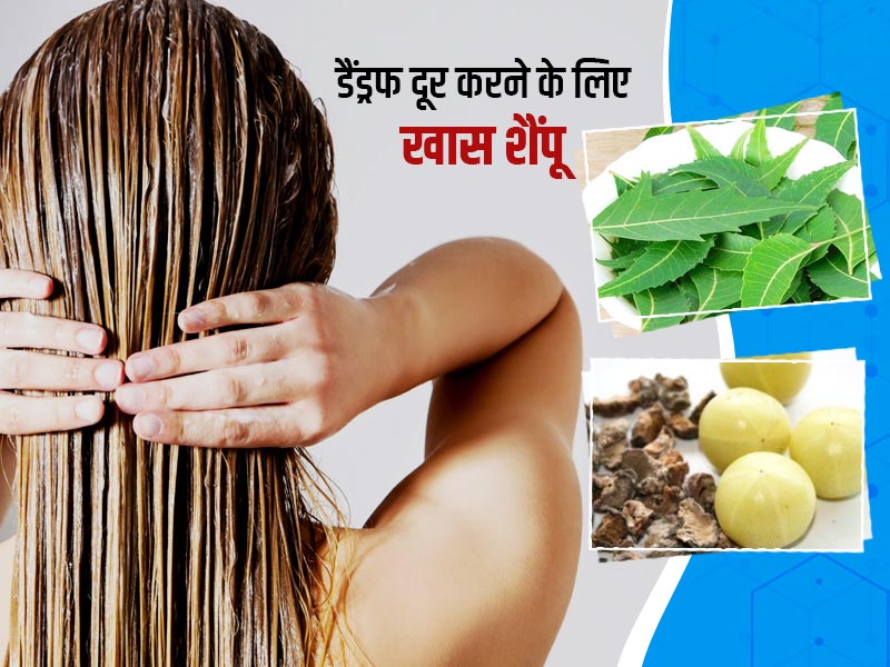 सर्दियों में बालों की रूसी से हैं परेशान तो, इस्तेमाल करें आमलकी और नीम से बना ये एंटी डेंड्रफ शैंपू