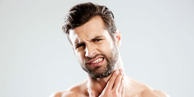 beard dandruff