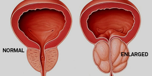 Insideenlarged