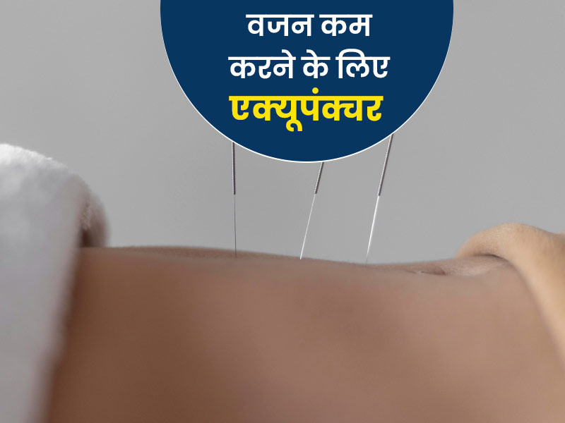 वजन कम करने में एक्यूपंक्चर कैसे है मददगार? एक्सपर्ट से जानें फायदे, तरीका और सावधानियां