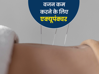 वजन कम करने में एक्यूपंक्चर कैसे है मददगार? एक्सपर्ट से जानें फायदे, तरीका और सावधानियां