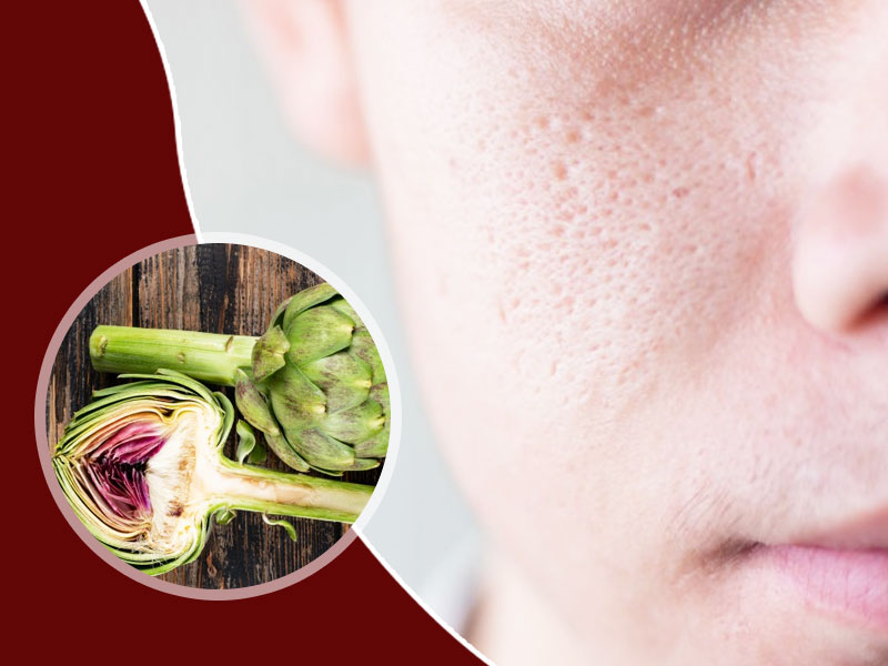 Artichoke For Skin Here s How To Incorporate It In Your Skincare