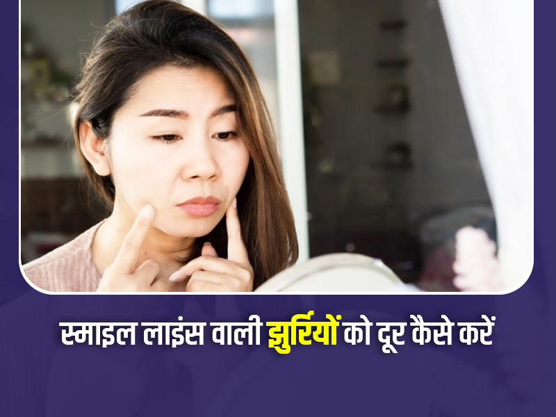 खूबसूरती खराब कर सकती है स्माइल लाइंस की झुर्रियों, इसे कम करने लिए करें ये 3 एक्सरसाइज
