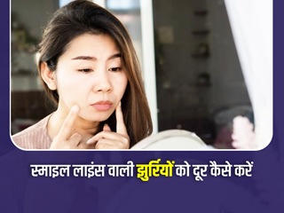 खूबसूरती खराब कर सकती है स्माइल लाइंस की झुर्रियों, इसे कम करने लिए करें ये 3 एक्सरसाइज