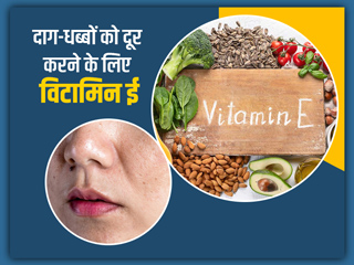 मुंहासे के निशान हों या झाइयां, त्वचा के सब दाग-धब्बों को दूर करता है विटामिन ई, जानें इस्तेमाल