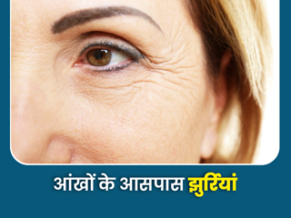 आंखों के आसपास की झुर्रियां बढ़ा सकती हैं आपकी ये 6 आदतें