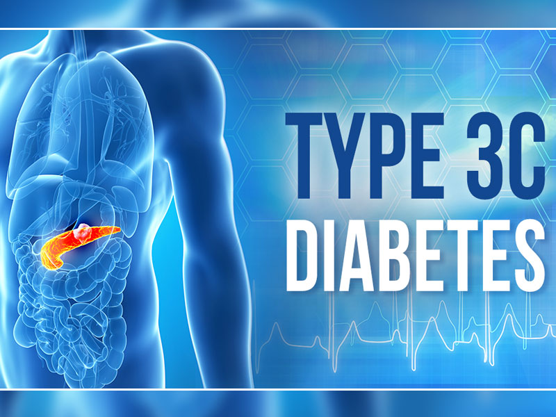 Type 3c Diabetes: टाइप 3c डायबिटीज क्या होता है? डॉक्टर से जानें इसके लक्षण, कारण और बचाव के टिप्स