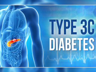Type 3c Diabetes: टाइप 3c डायबिटीज क्या होता है? डॉक्टर से जानें इसके लक्षण, कारण और बचाव के टिप्स