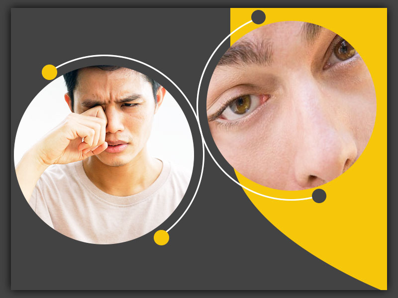 आंख फड़कना शुभ-अशुभ का संकेत है या शरीर की कोई समस्‍या या बीमारी? डॉक्टर से जानें इसके वैज्ञानिक कारण