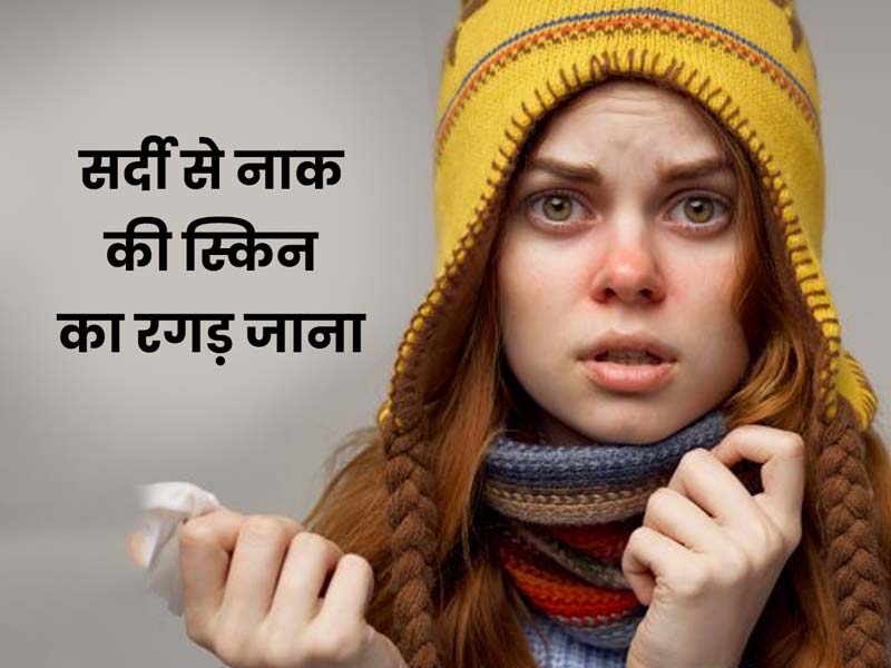 नाक बहने के कारण रगड़ से छिल गई है आस-पास की त्वचा, अपनाएं ये 5 टिप्स