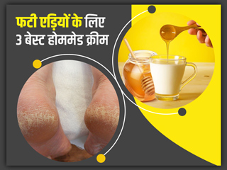 फटी एड़ियों से छुटकारा पाने के लिए घर पर बनाएं ये 3 DIY क्रीम, जानें बनाने का तरीका