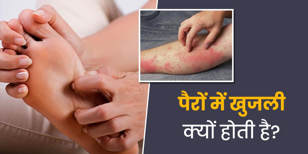 Itchy Feet in Winter Causes Home Remedies in Hindi सर्दियों में पैरों