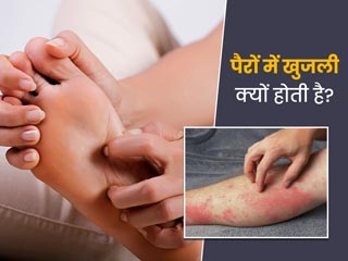 सर्दियों में पैरों में खुजली होने के कारण क्या हो सकते हैं? डॉक्टर से जानें इस खुजली के लिए घरेलू उपाय