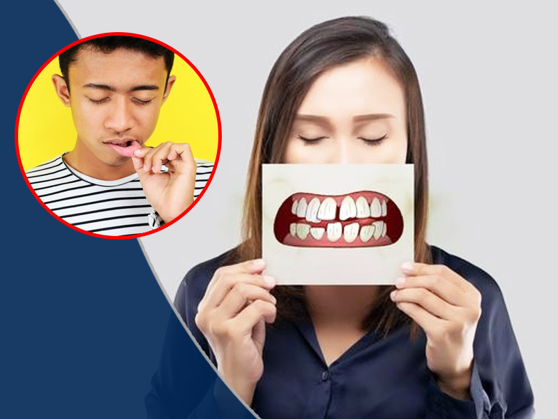 Oral Symptoms of Different Disorders, Watch Out Your Dental Health For Holistic Wellness