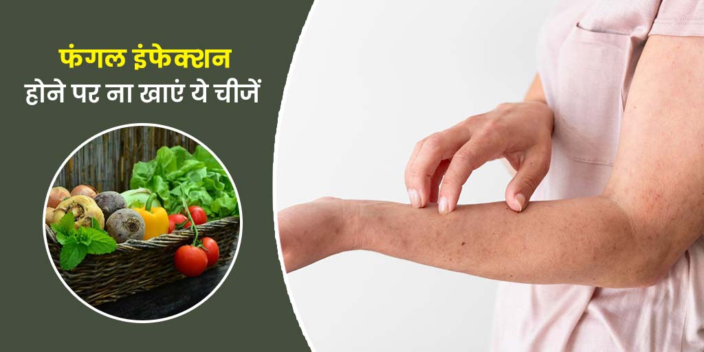 Things To Not Eat If You Have Fungal & Yeast Infection In Hindi। फंगल इंफेक्शन होने पर क्या ना