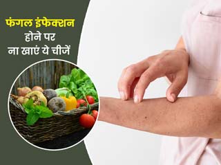 फंगल इंफेक्शन होने पर क्या नहीं खाना चाहिए? एक्सपर्ट से जानें किन चीजों से परहेज है जरूरी