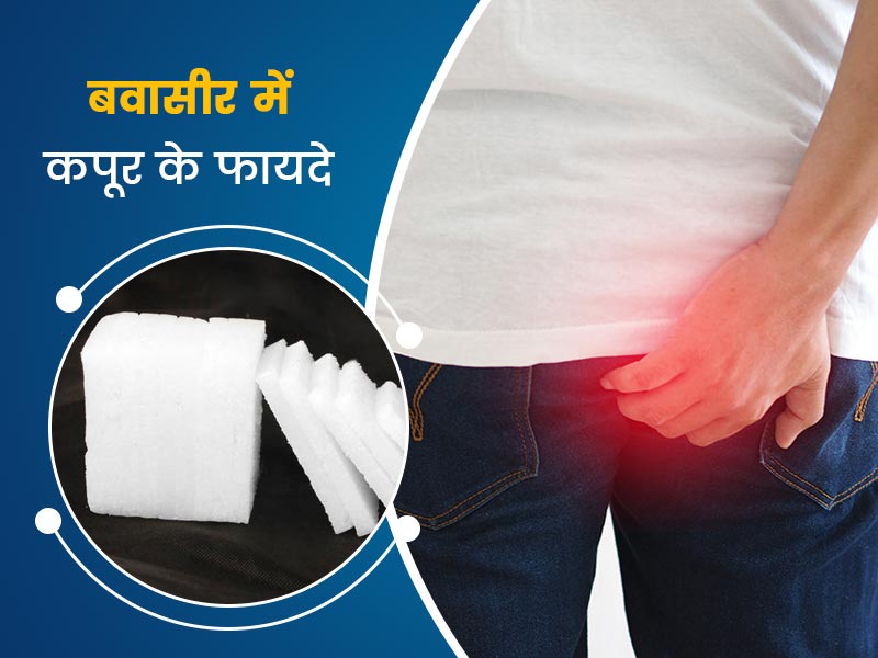 बवासीर में कपूर के फायदे: पाइल्स की समस्या में राहत दिलाता है कपूर, आयुर्वेदाचार्य से जानें इस्तेमाल का तरीका