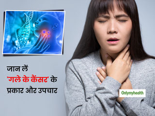 कितने प्रकार का होता है गले का कैंसर? जानें इसके चरण, लक्षण, कारण, परीक्षण और बचाव