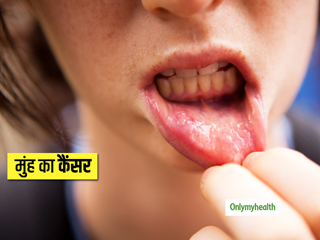 World Cancer Day 2021: सिर्फ तंबाकू नहीं, इन 5 कारणों से भी हो सकता है मुंह का कैंसर