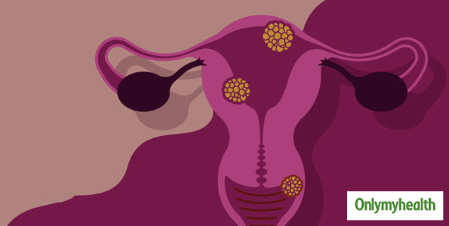 insideLeukorrhea