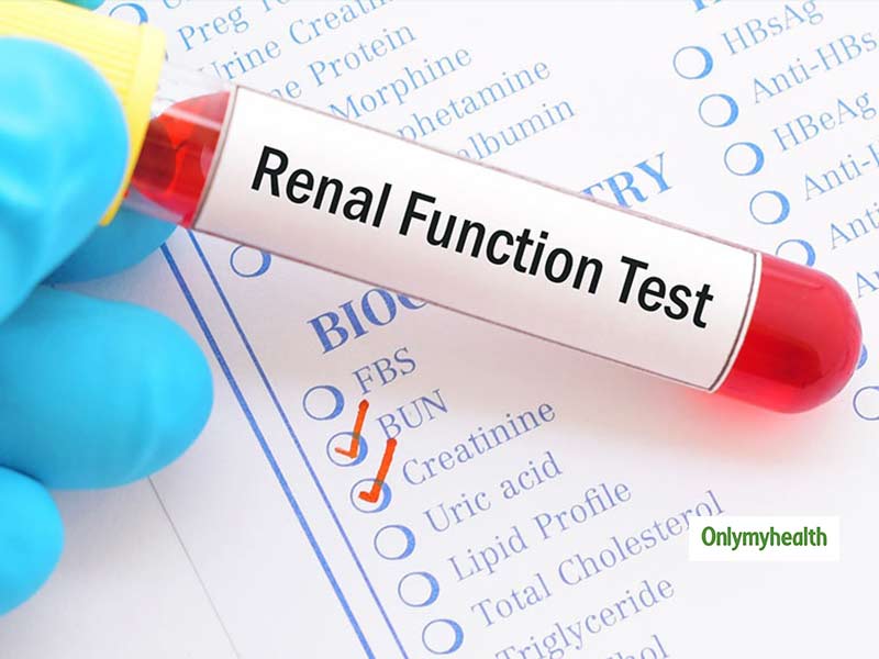 What Is Kidney Function Test and How It Can Help In Preventing Kidney Diseases