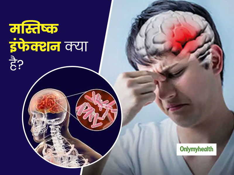 Brain Infection: मस्तिष्क संक्रमण (ब्रेन इंफेक्शन) क्या है? एक्सपर्ट से जानें इसके सभी लक्षण, कारण और इलाज